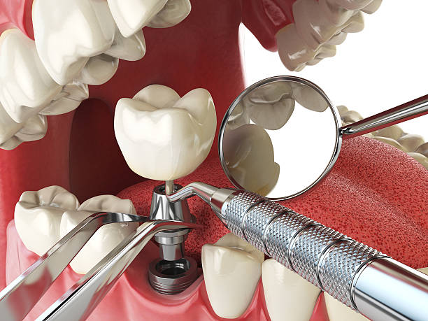 Trusted WA Emergency Dental Service Experts